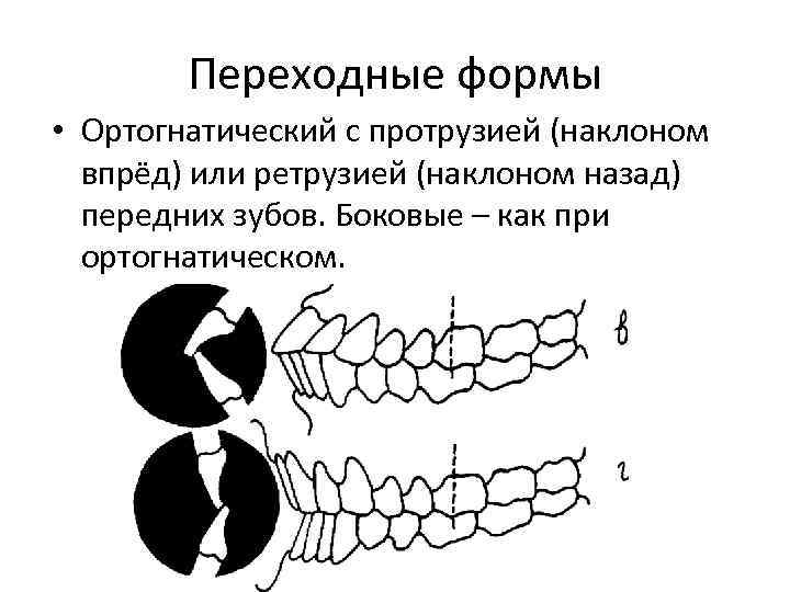 Виды прикуса схема