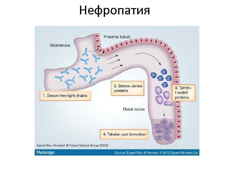 Нефропатия 