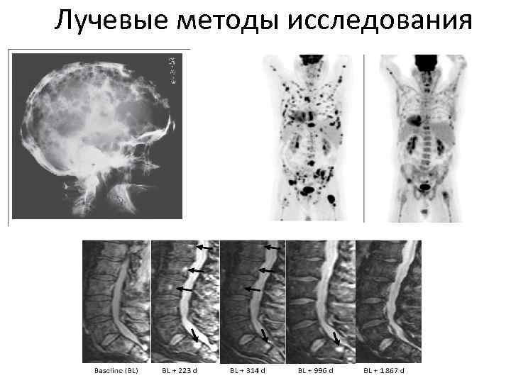 Лучевые методы исследования 