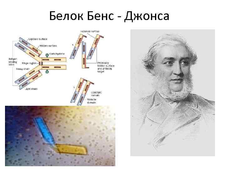 Белок Бенс - Джонса 