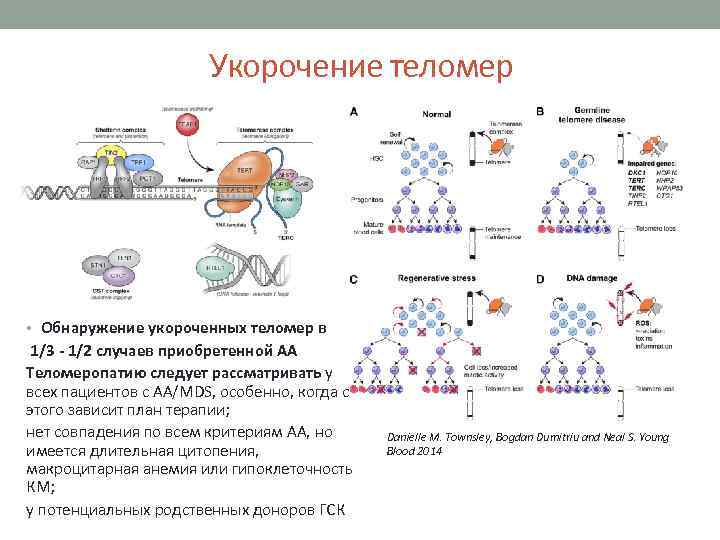 Укорочение теломер • Обнаружение укороченных теломер в 1/3 - 1/2 случаев приобретенной АА Теломеропатию