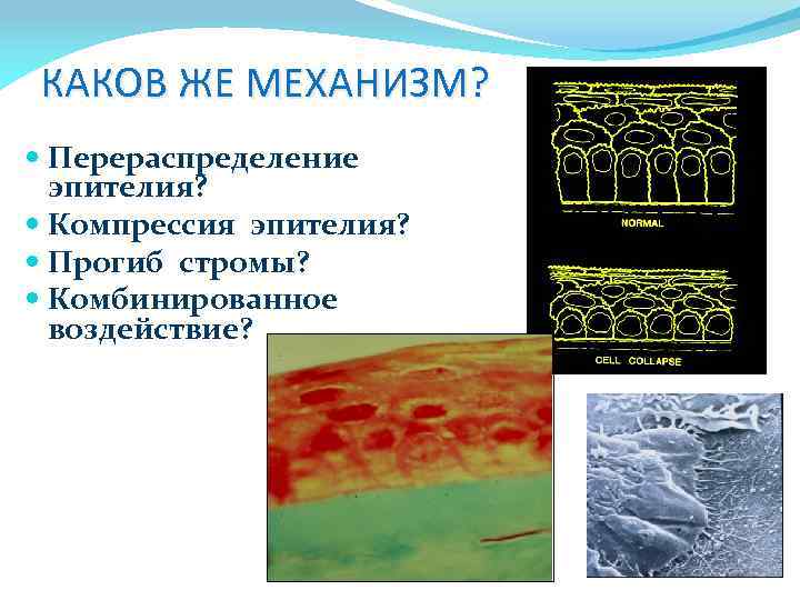 КАКОВ ЖЕ МЕХАНИЗМ? Перераспределение эпителия? Компрессия эпителия? Прогиб стромы? Комбинированное воздействие? 