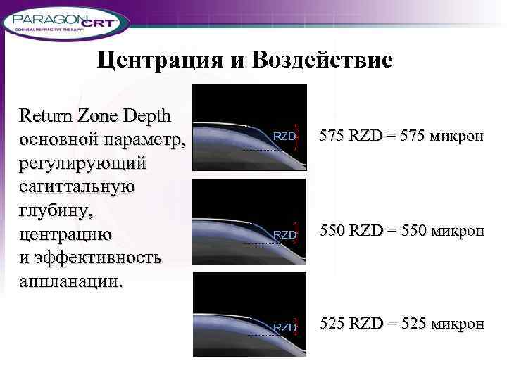 Центрация и Воздействие Return Zone Depth основной параметр, регулирующий сагиттальную глубину, центрацию и эффективность