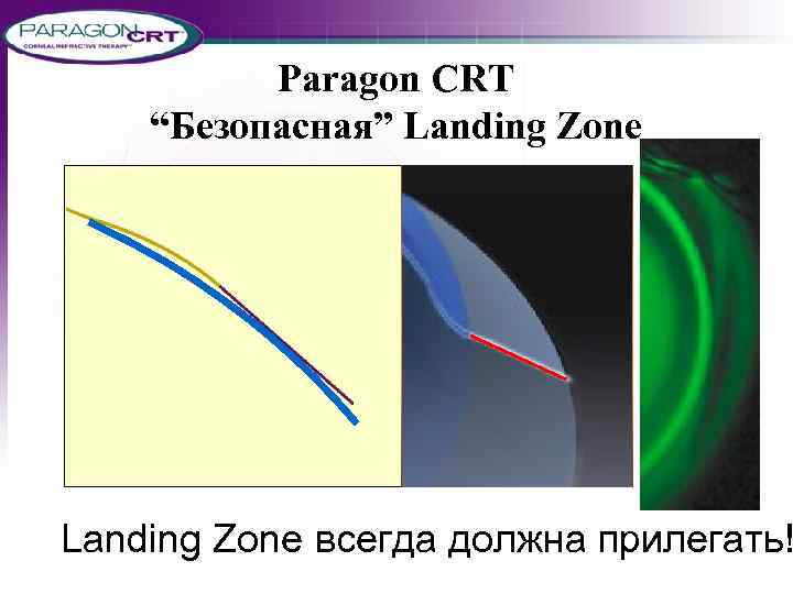 Paragon CRT “Безопасная” Landing Zone всегда должна прилегать! 