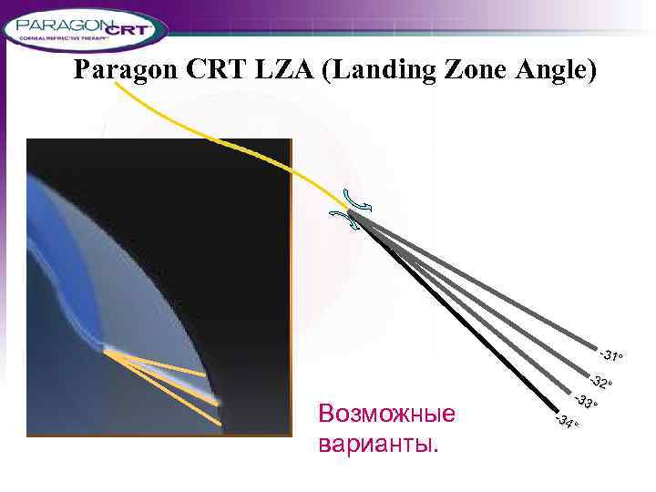 Paragon CRT LZA (Landing Zone Angle) -31° Возможные варианты. -32 ° -33 ° -34