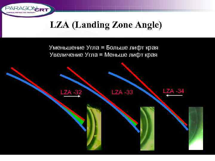 LZA (Landing Zone Angle) Уменьшение Угла = Больше лифт края Увеличение Угла = Меньше