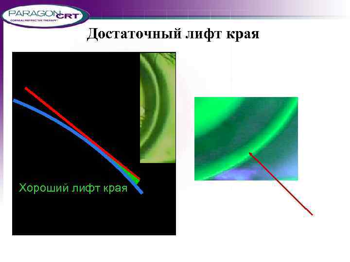 Достаточный лифт края Хороший лифт края 