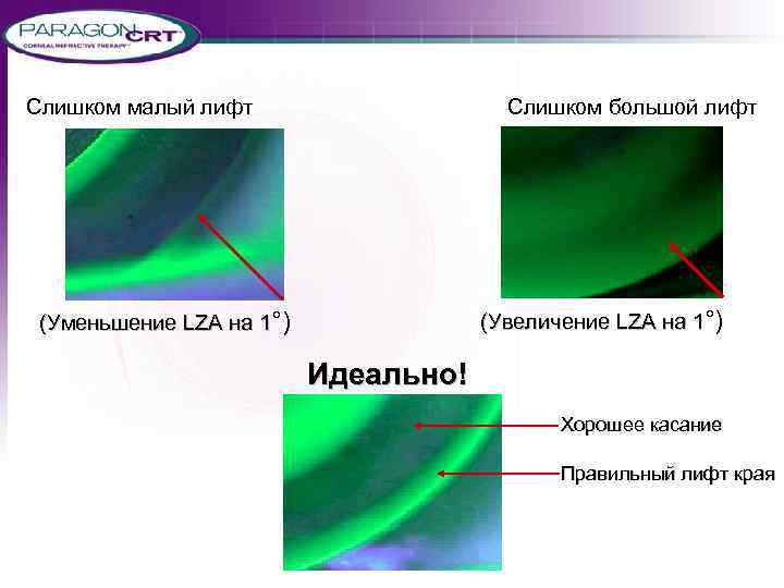 Слишком малый лифт Слишком большой лифт (Увеличение LZA на 1°) (Уменьшение LZA на 1°)