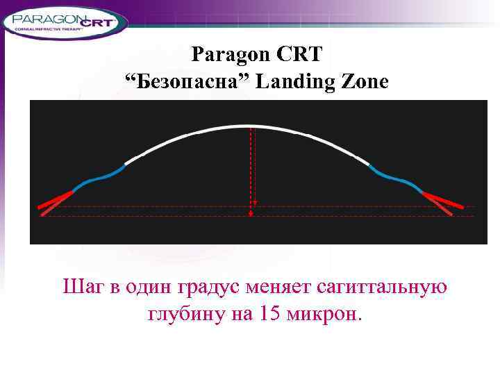 Paragon CRT “Безопасна” Landing Zone Шаг в один градус меняет сагиттальную глубину на 15