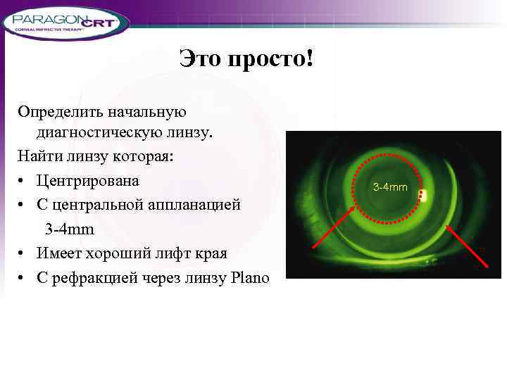 Это просто! Определить начальную диагностическую линзу. Найти линзу которая: • Центрирована • С центральной