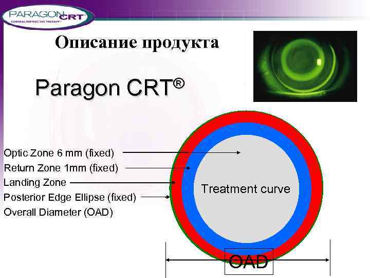 Описание продукта Paragon CRT® Optic Zone 6 mm (fixed) Return Zone 1 mm (fixed)