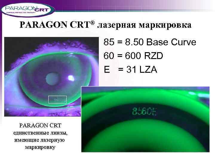 PARAGON CRT® лазерная маркировка 85 = 8. 50 Base Curve 60 = 600 RZD