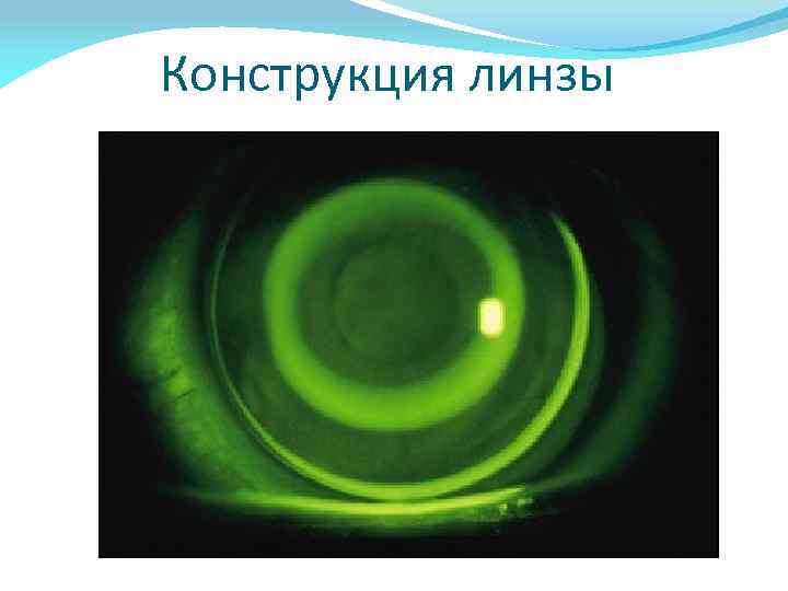 Конструкция линзы 
