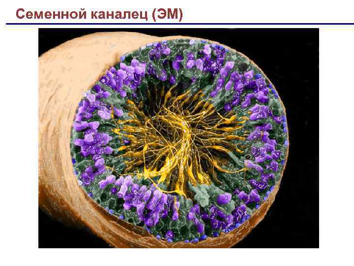 Семенной каналец (ЭМ) 