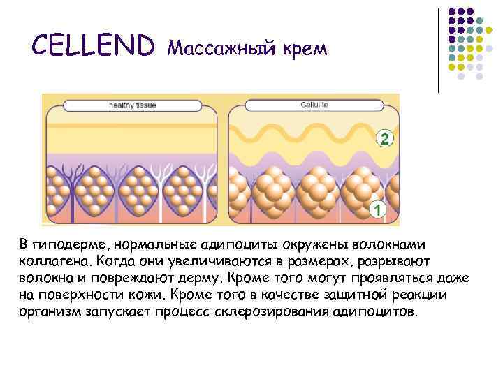 CELLEND Массажный крем В гиподерме, нормальные адипоциты окружены волокнами коллагена. Когда они увеличиваются в