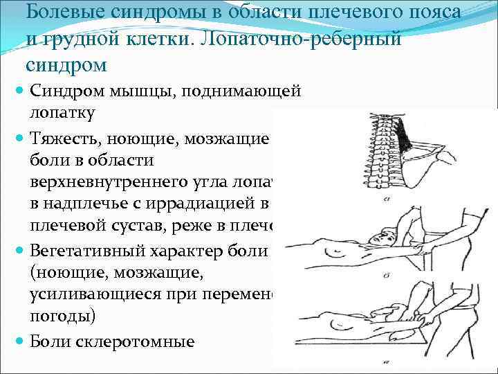 Болевые синдромы в области плечевого пояса и грудной клетки. Лопаточно-реберный синдром Синдром мышцы, поднимающей