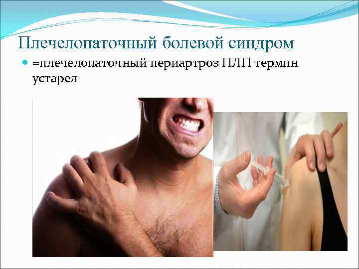 Плечелопаточный болевой синдром =плечелопаточный периартроз ПЛП термин устарел 