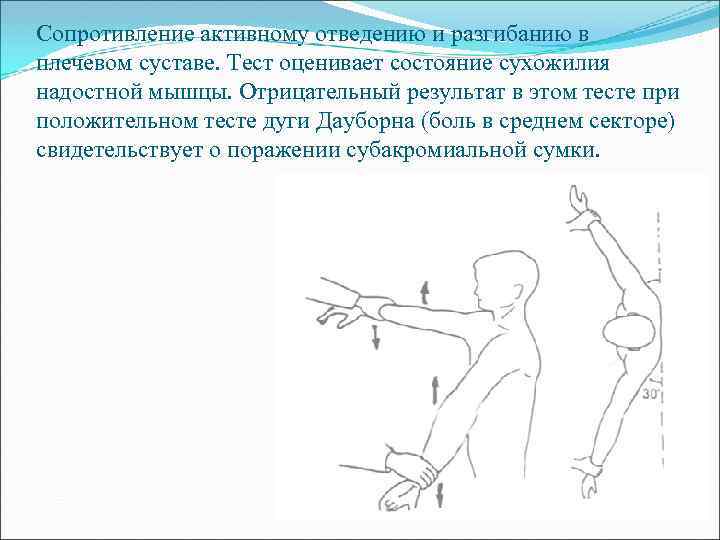 Сопротивление активному отведению и разгибанию в плечевом суставе. Тест оценивает состояние сухожилия надостной мышцы.