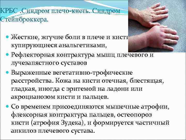 КРБС. Синдром плечо-кисть. Синдром Стейнброккера. Жесткие, жгучие боли в плече и кисти, не купирующиеся