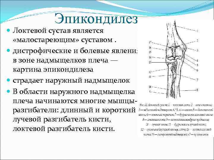 Эпикондилез Локтевой сустав является «малостареющим» суставом. дистрофические и болевые явления в зоне надмыщелков плеча