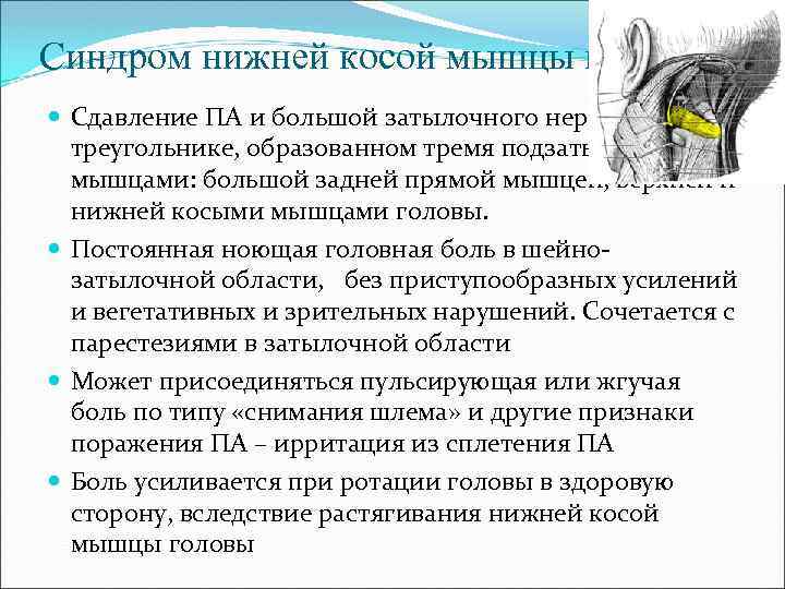 Синдром нижней косой мышцы головы Сдавление ПА и большой затылочного нерва в треугольнике, образованном