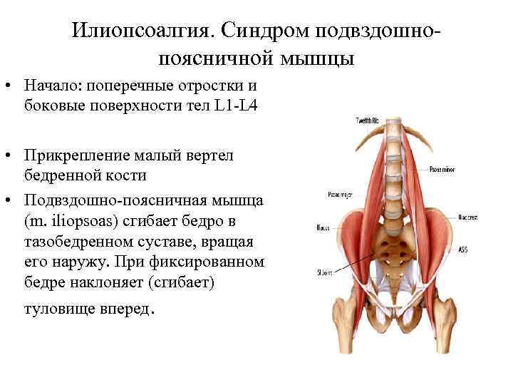 Илиопсоалгия. Синдром подвздошнопоясничной мышцы • Начало: поперечные отростки и боковые поверхности тел L 1