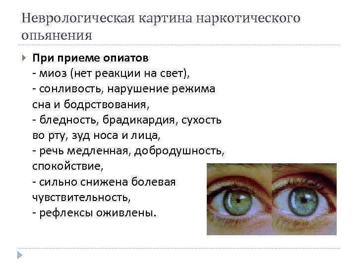 Неврологическая картина наркотического опьянения При приеме опиатов - миоз (нет реакции на свет), -