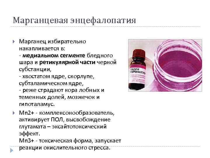 Марганцевая энцефалопатия Марганец избирательно накапливается в: - медиальном сегменте бледного шара и ретикулярной части