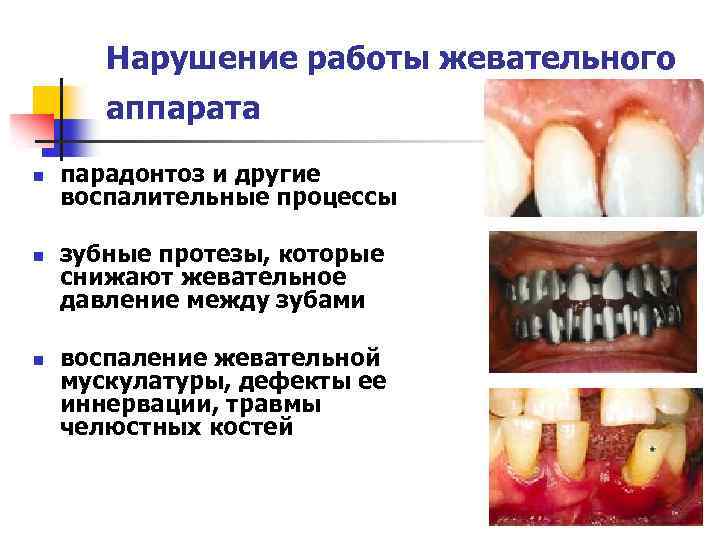 Нарушение работы жевательного аппарата n n n парадонтоз и другие воспалительные процессы зубные протезы,