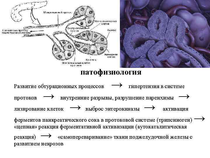 патофизиология Развитие обтурационных процессов протоков → → гипертензия в системе внутренние разрывы, разрушение паренхимы