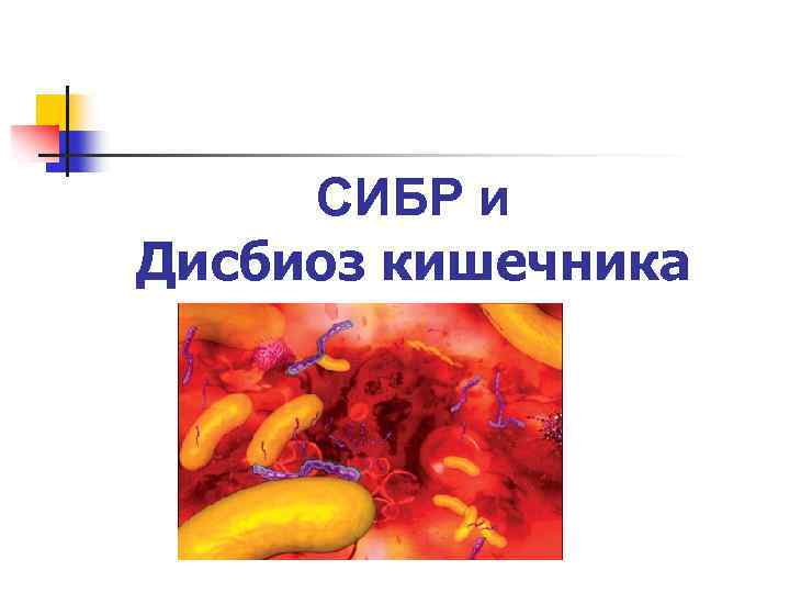 СИБР и Дисбиоз кишечника 