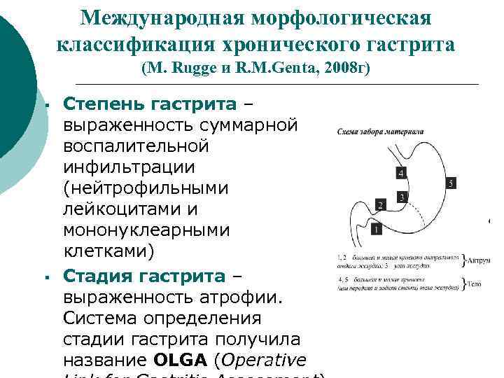 Международная морфологическая классификация хронического гастрита (M. Rugge и R. M. Genta, 2008 г) §