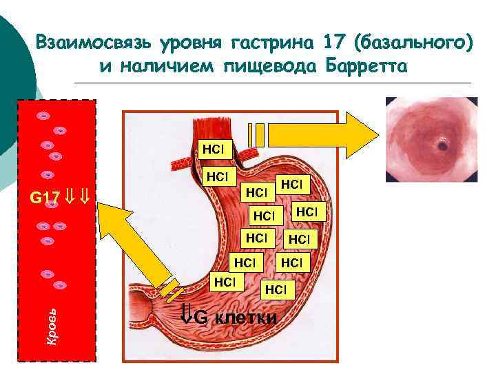 Гастрин 17 понижен. Гастрин 17 базальный пониженный. Гастрин 17 базальный повышен. Низкий уровень гастрина. Гастрин 17 базальный повышен причины.