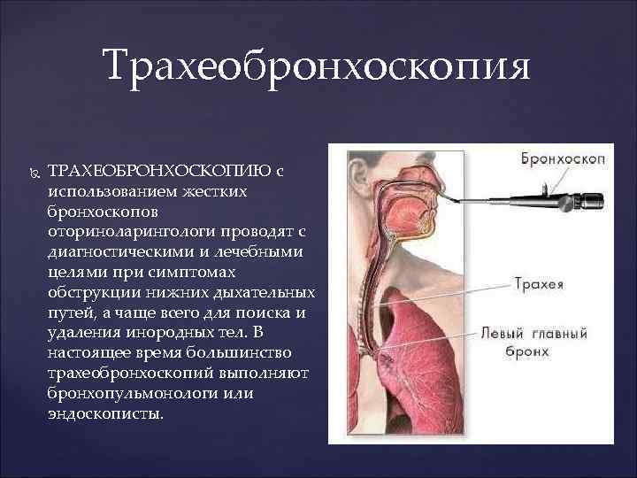 Трахеобронхоскопия ТРАХЕОБРОНХОСКОПИЮ с использованием жестких бронхоскопов оториноларингологи проводят с диагностическими и лечебными целями при