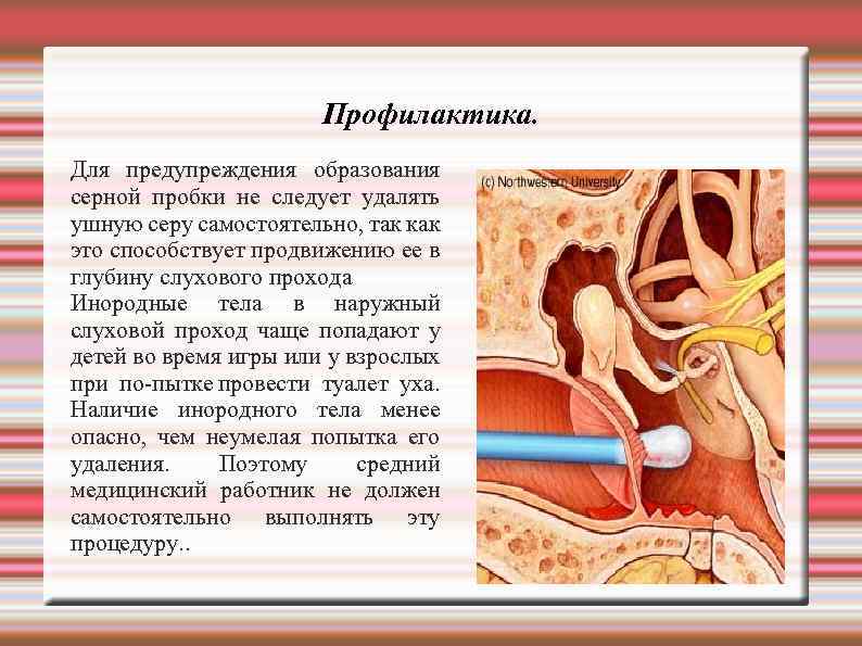 Профилактика. Для предупреждения образования серной пробки не следует удалять ушную серу самостоятельно, так как