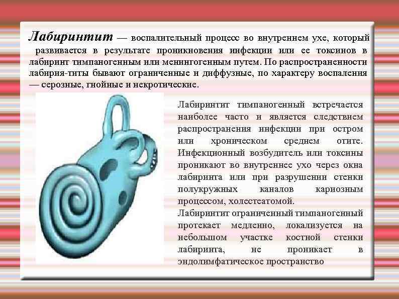 Лабиринтит — воспалительный процесс во внутреннем ухе, который развивается в результате проникновения инфекции или
