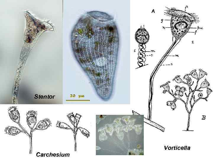 Stentor Vorticella Carchesium 