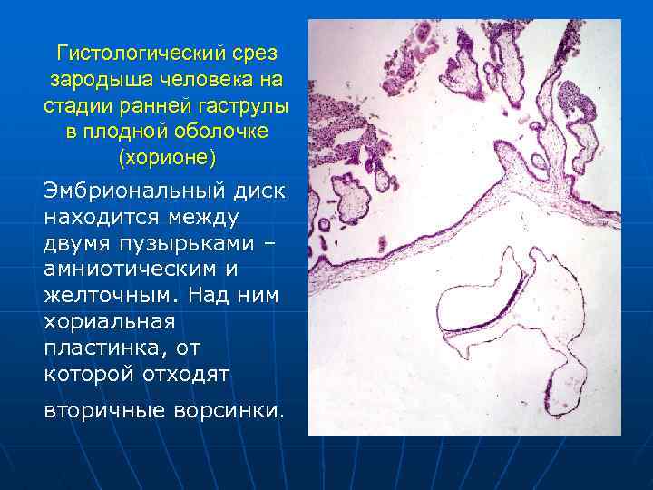 Гистологический срез зародыша человека на стадии ранней гаструлы в плодной оболочке (хорионе) Эмбриональный диск