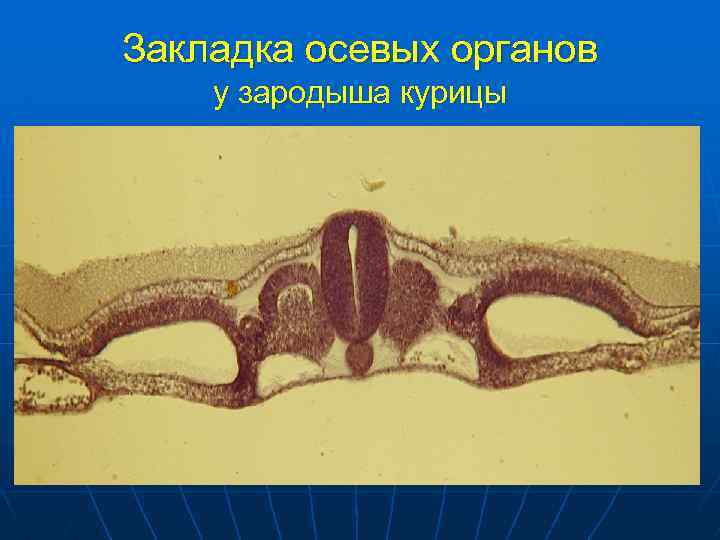 Закладка осевых органов у зародыша курицы 