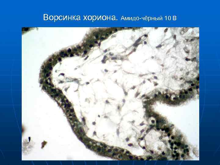 Ворсинка хориона. Амидо-чёрный 10 В 