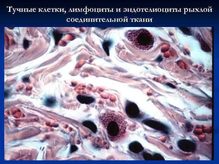 Тучные клетки, лимфоциты и эндотелиоциты рыхлой соединительной ткани 
