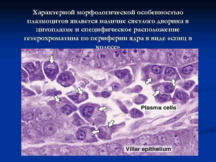 Характерной морфологической особенностью плазмоцитов является наличие светлого дворика в цитоплазме и специфическое расположение гетерохроматина