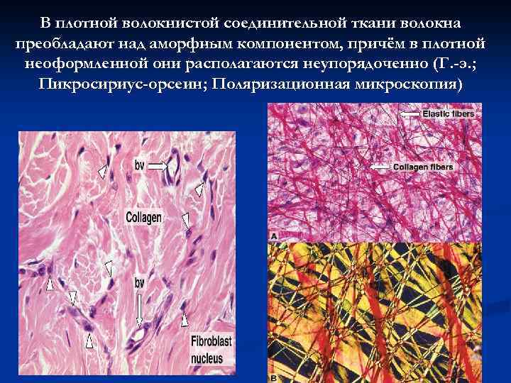 В плотной волокнистой соединительной ткани волокна преобладают над аморфным компонентом, причём в плотной неоформленной
