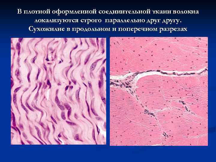 В плотной оформленной соединительной ткани волокна локализуются строго параллельно другу. Сухожилие в продольном и