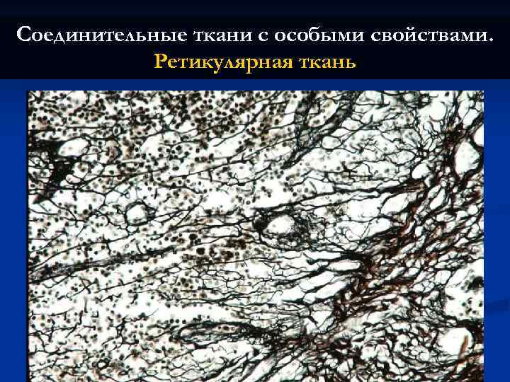Соединительные ткани с особыми свойствами. Ретикулярная ткань 