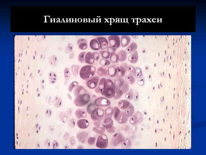 Гиалиновый хрящ трахеи 