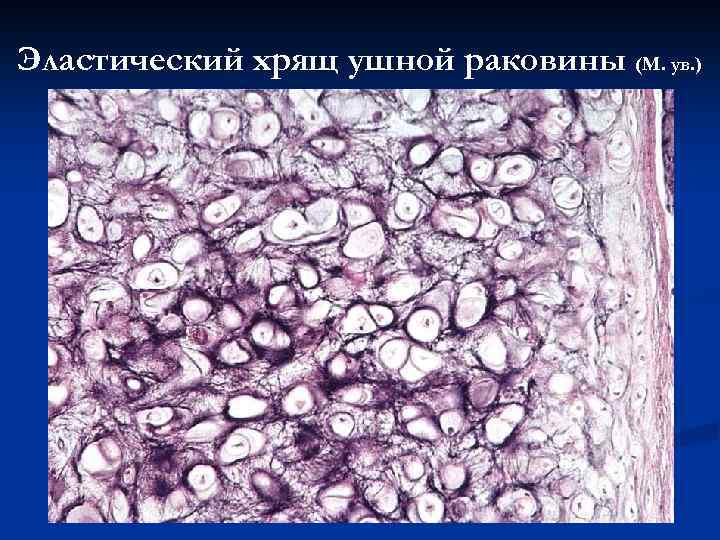 Эластический хрящ ушной раковины (М. ув. ) 