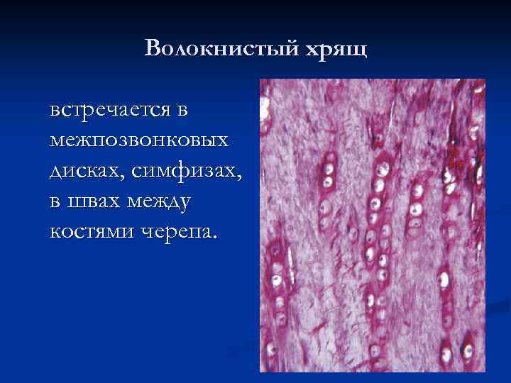 Волокнистый хрящ встречается в межпозвонковых дисках, симфизах, в швах между костями черепа. 