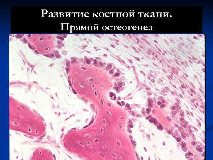 Развитие костной ткани. Прямой остеогенез 