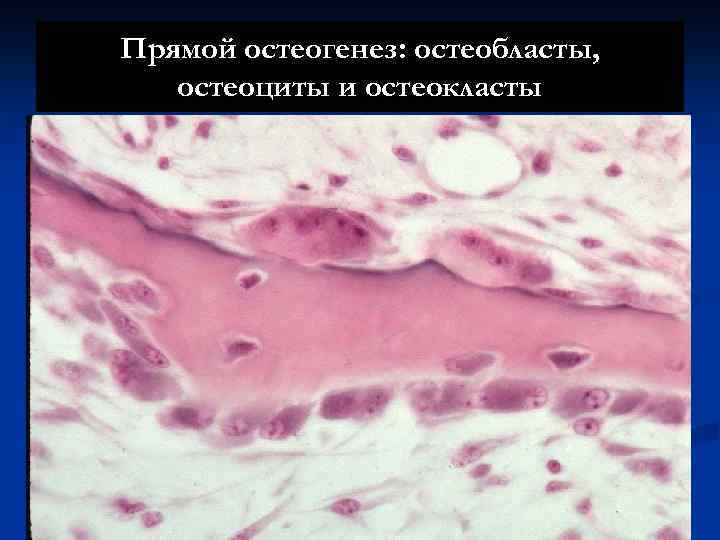 Прямой остеогенез: остеобласты, остеоциты и остеокласты 